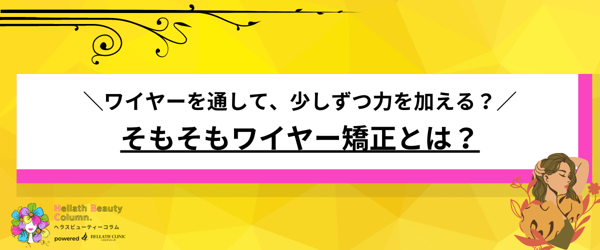 ワイヤー矯正