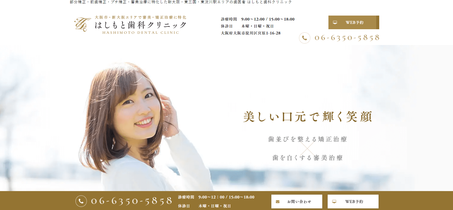 マウスピース矯正 大阪