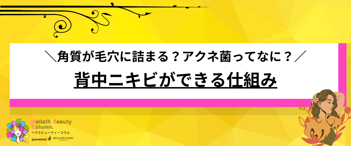 背中ニキビ 治療 おすすめ