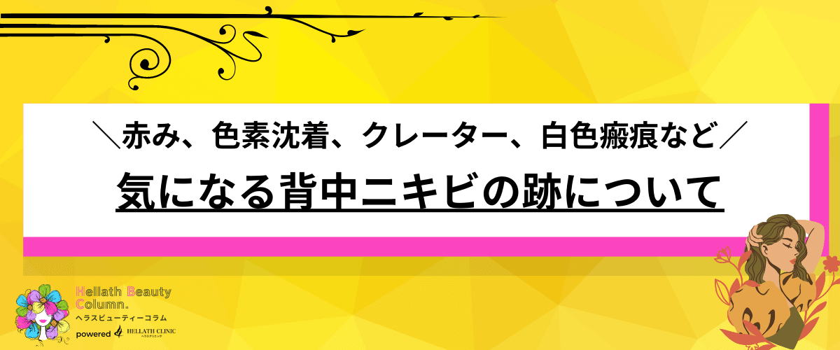 背中ニキビ 治療 おすすめ
