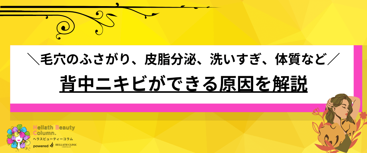 背中ニキビ 治療 おすすめ