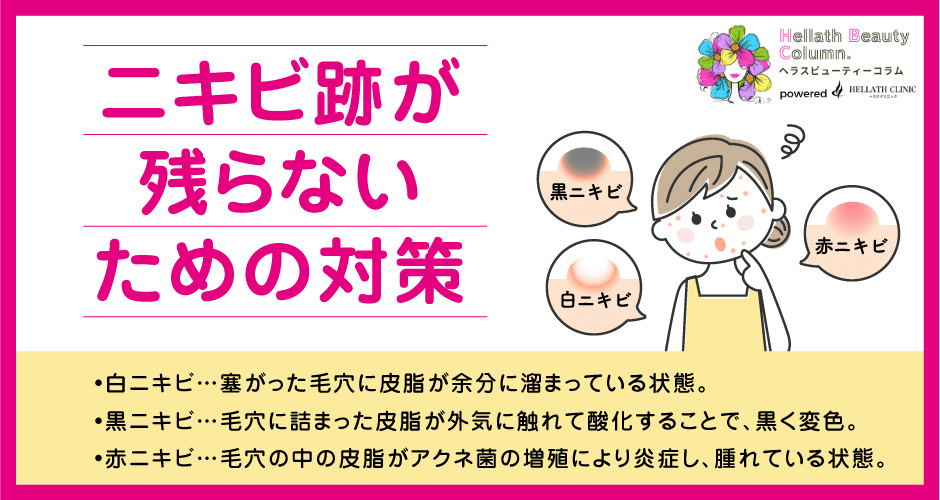 ニキビ跡消す_対策法