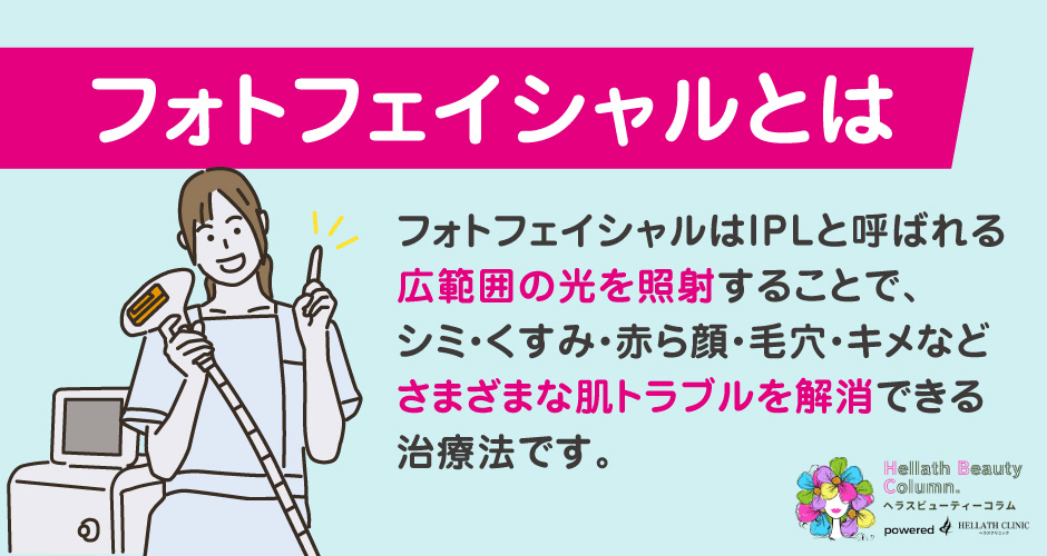 フォトフェイシャルおすすめ_フォトフェイシャルとは