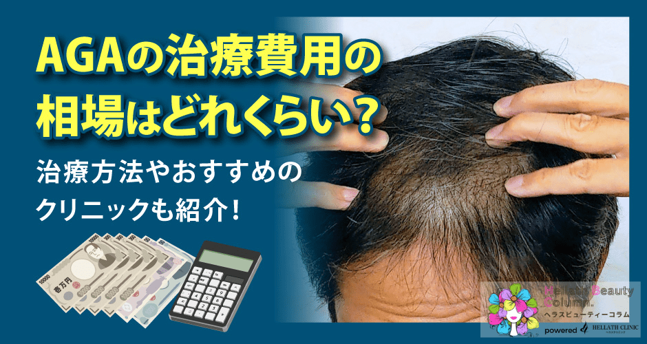 AGAの治療費用相場_アイキャッチ