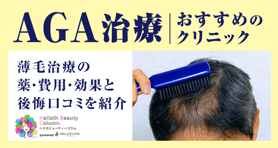 aga治療おすすめ_アイキャッチ