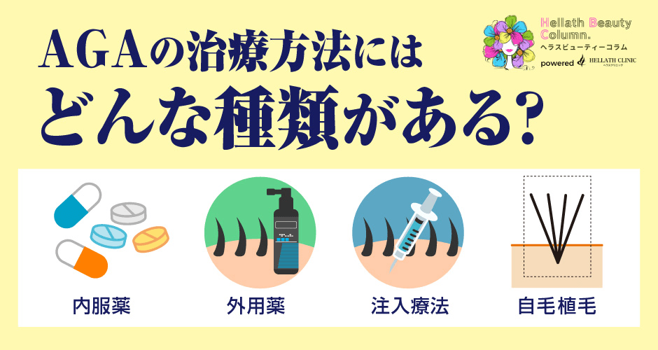 aga治療おすすめ_種類