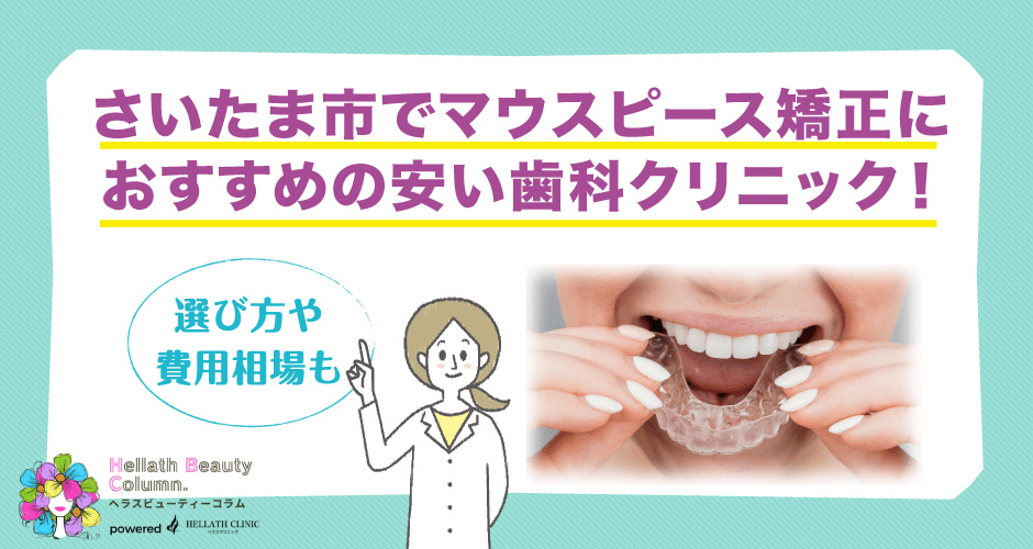 マウスピース矯正埼玉_アイキャッチ