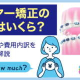 ワイヤー矯正値段_アイキャッチ