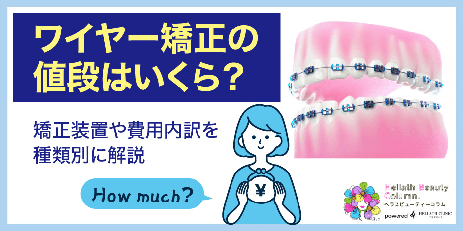 ワイヤー矯正値段_アイキャッチ