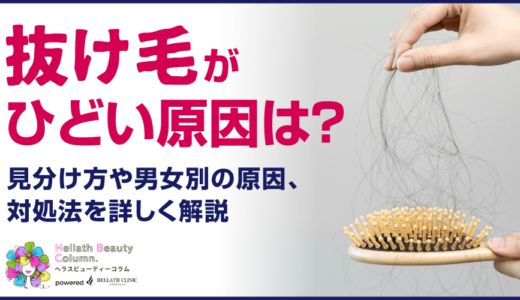抜け毛がひどい原因は？見分け方や男女別の原因・対処法を詳しく解説