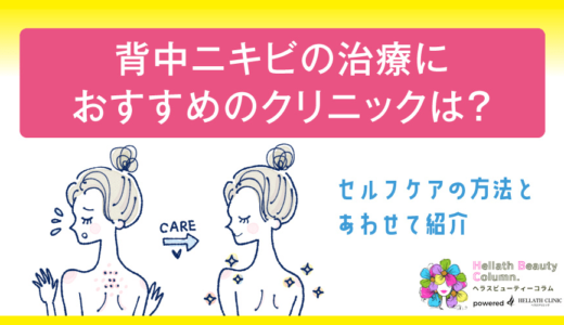 背中ニキビの治療におすすめのクリニックは？セルフケアの方法とあわせて紹介