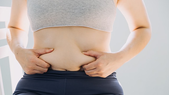 脂肪吸引はセルライト除去にも効果的ですか？