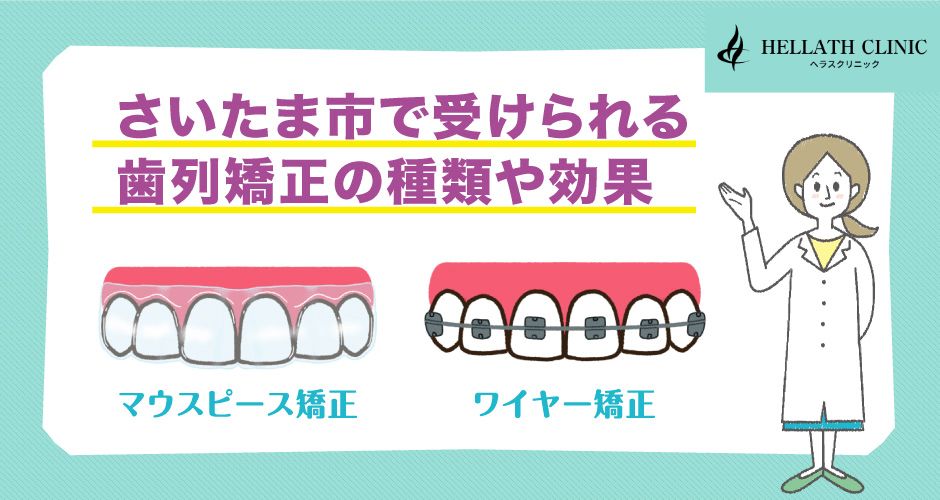 【埼玉県】さいたま市で受けられる歯列矯正の種類や効果
