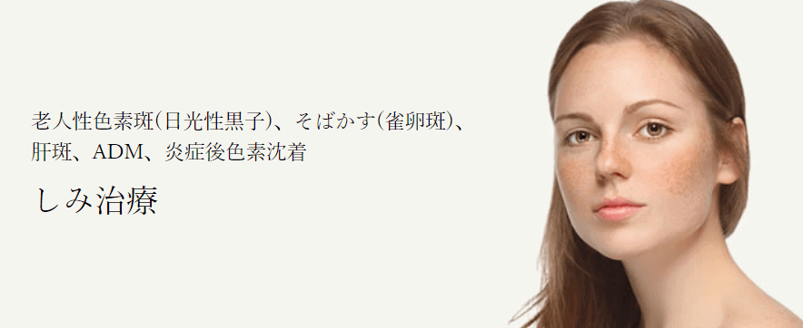 シミ取り放題 おすすめ