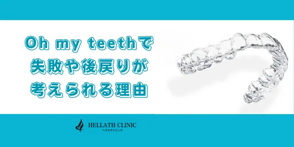 Oh my teethで失敗や後戻りが考えられる理由